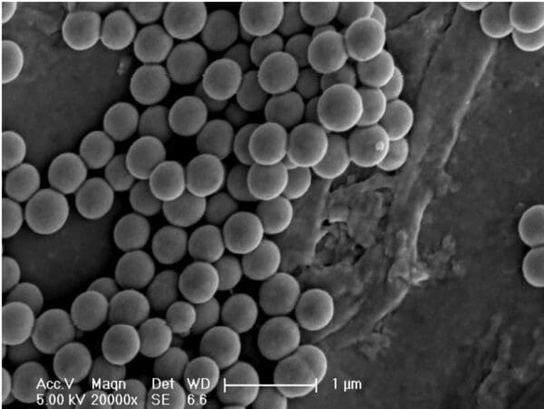  used second hand electron microscope for sale